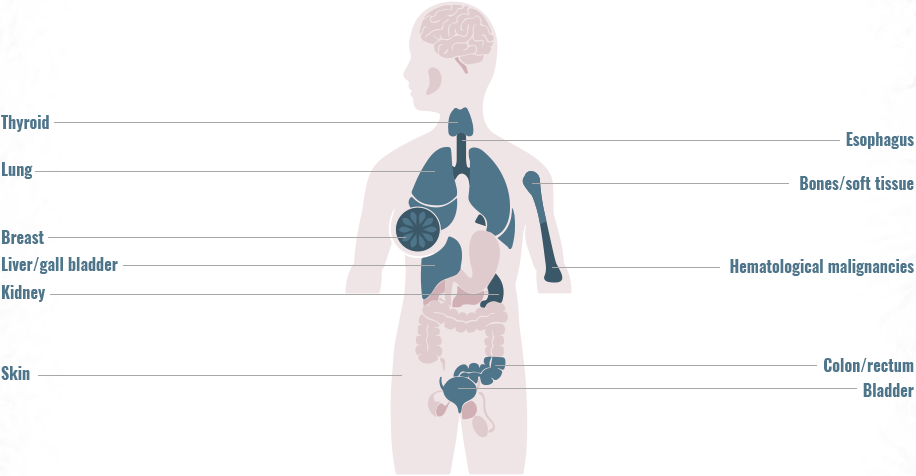 Distribution of ALK gene fusions across primary tumor sites graphic